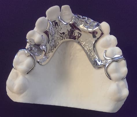 metals used to fabricate removable partial denture frameworks|clear framework for partial dentures.